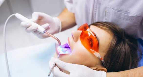 Experience Comprehensive Dental Scaling for Optimal Oral Health